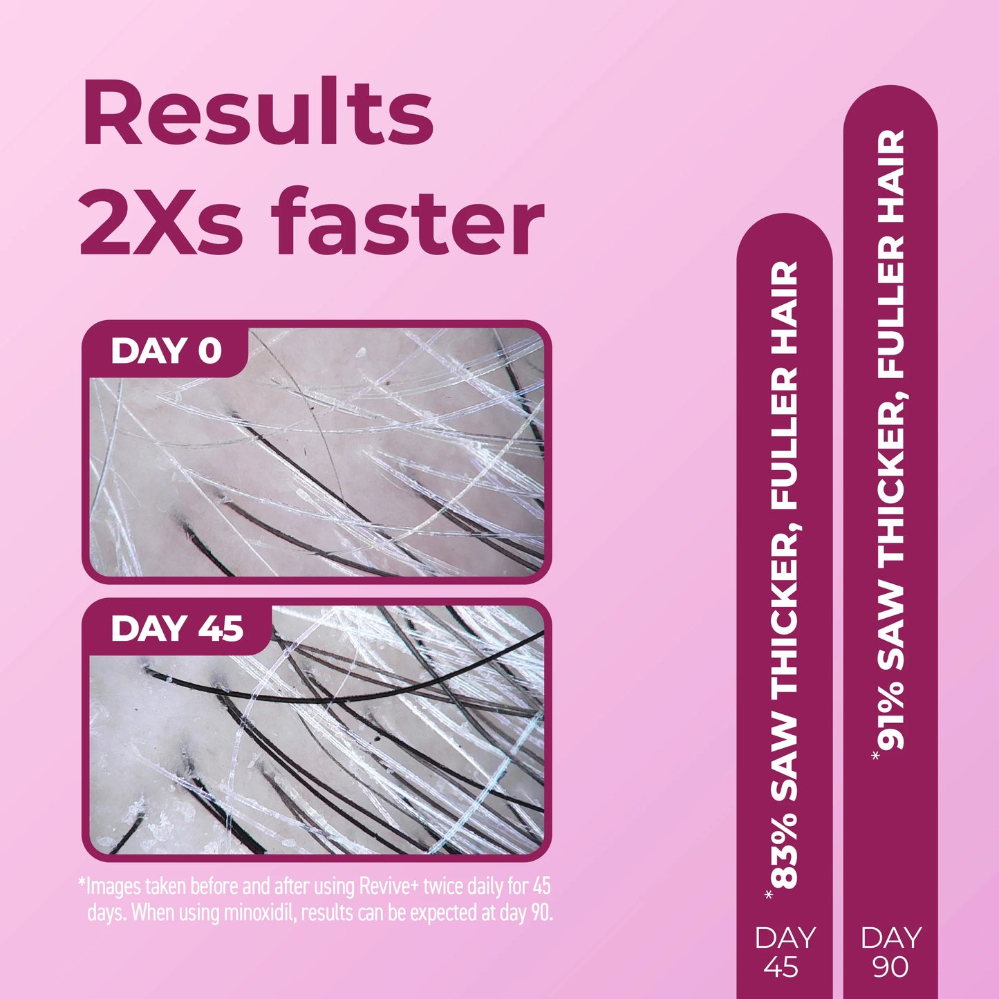 BosleyMD WOMEN'S REVIVE+ Densifying Treatment Foam